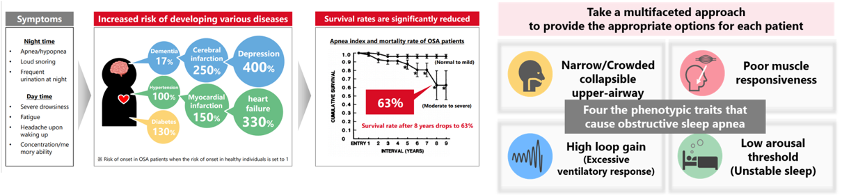 Obstructive Sleep Apnea