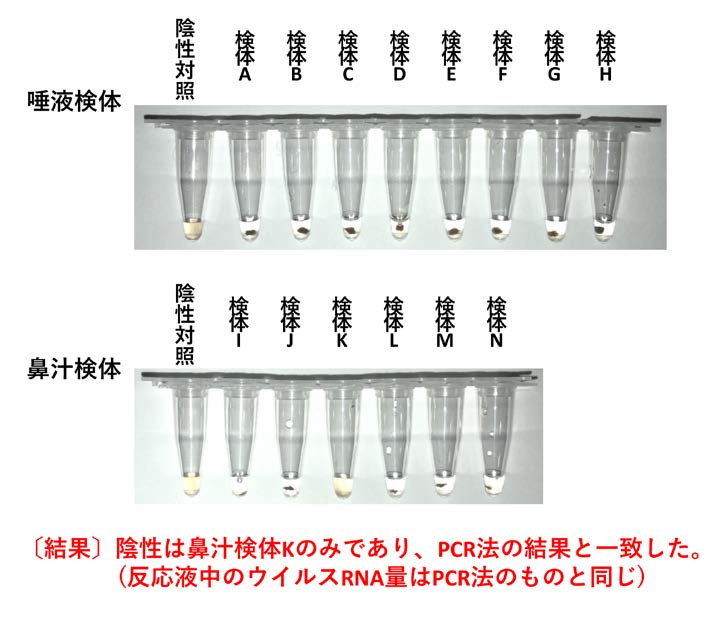 図４： SATIC法による検査結果