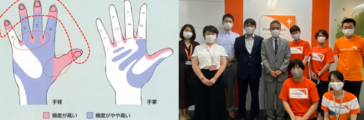 Left：The important point of washing hands,  Right：Staff group photo 